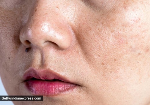 Will skincare clog pores?